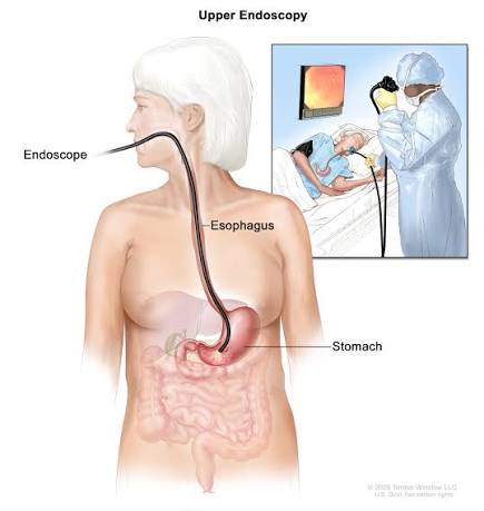 Endoscopy procedure